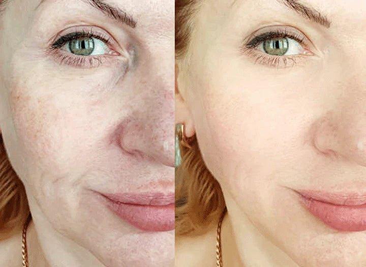 TurmSerum™ | Jouw geheim voor totaal welzijn