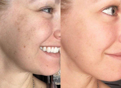 TurmSerum™ | Jouw geheim voor totaal welzijn